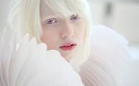 Девушка-альбинос