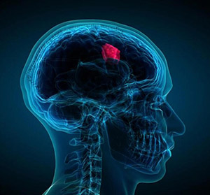  Бор: неврология и головной мозг