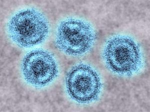 Эбола: вирус Рестон
