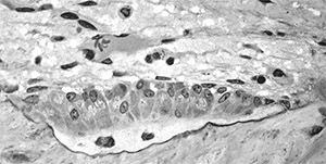 Кемпферол: остеобласты