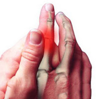 Химиотерапия: периферийная невропатия