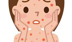 Краснуха, также известная как «немецкая корь» или «трехдневная корь» - инфекция, вызываемая вирусом краснухи