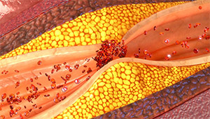 Lactobacillus reuteri: холестерин 