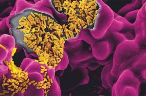 микробиом и детский слух