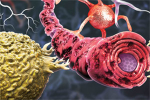 Модафинил: множественный склероз