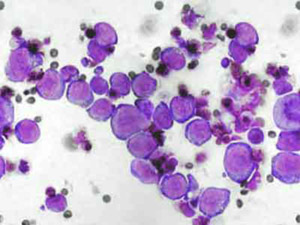Мордовник: лейкемия