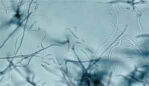 Взаимодействие наттокиназы с бактерией Streptomyces omiyaensis