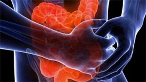 Никотин и язвенный колит