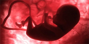 Эмбриональные опухоли иногда диагностируется еще в утробе матери