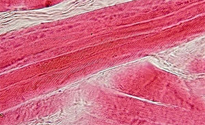 Родиола розовая: сердечная ткань