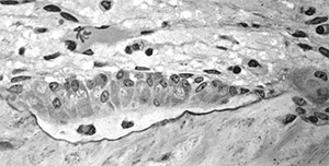 Сезамин: остеобласты 